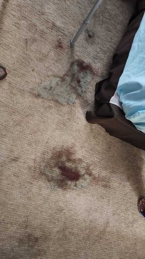 Before & After Carpet Cleaning in Miami, FL (1)